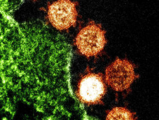 Electron microscope image of Severe Acute Respiratory Syndrome (SARS) virus particles (orange) found near an infected cell (green).