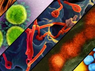 Electron microscope images of the viruses that cause influenza, Covid-19, Ebola, Zika, and mpox.