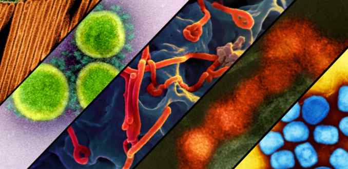 Electron microscope images of the viruses that cause influenza, Covid-19, Ebola, Zika, and mpox.